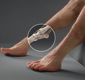 His lower ankle area has an extra joint for increased mobility